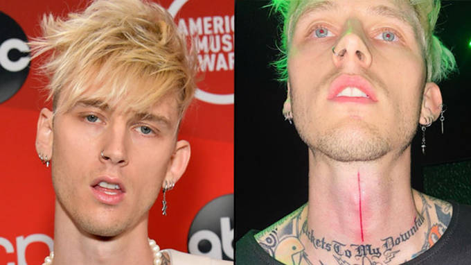 Machine Gun Kelly vient de se faire tatouer une fente sanglante dans la gorge 2 Machine Gun Kelly vient de se faire tatouer une fente sanglante dans la gorge - 1