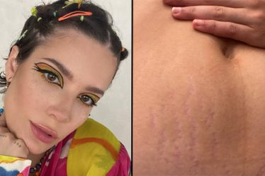 Halsey félicitée pour avoir montré ses vergetures après avoir accueilli bébé Ender - 9