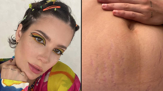 Halsey félicitée pour avoir montré ses vergetures après avoir accueilli bébé Ender 2 Halsey félicitée pour avoir montré ses vergetures après avoir accueilli bébé Ender - 1