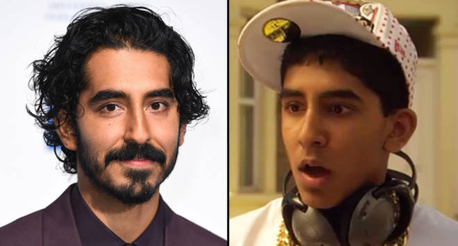Dev Patel dit qu'être appelé le personnage de Skins "le plus laid" a affecté son estime de soi 3 Dev Patel dit qu