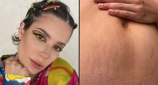 Halsey félicitée pour avoir montré ses vergetures après avoir accueilli bébé Ender 3 Halsey félicitée pour avoir montré ses vergetures après avoir accueilli bébé Ender