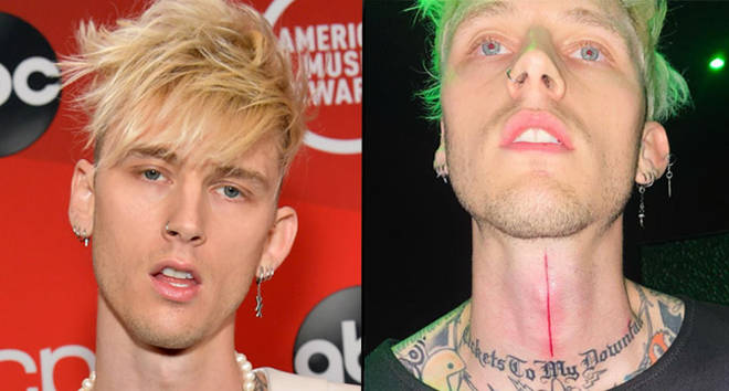 Machine Gun Kelly vient de se faire tatouer une fente sanglante dans la gorge 3 Machine Gun Kelly vient de se faire tatouer le cou