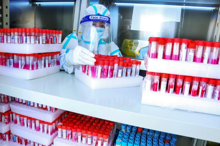 le point sur la pandémie dans le monde – Sciences et Avenir › Geeky News 2 le point sur la pandémie dans le monde – Sciences et Avenir › Geeky News - 1