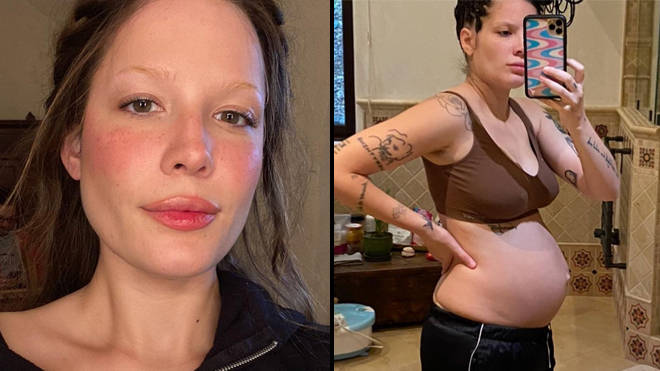 Halsey partage des photos de son corps après avoir accouché pour lutter contre la stigmatisation corporelle post-partum