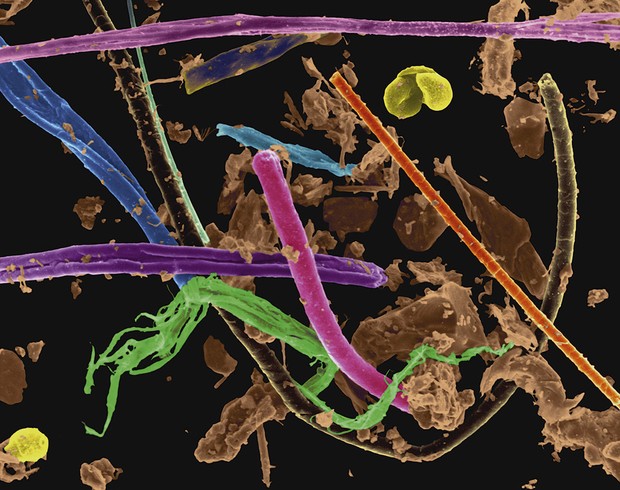 Cette image colorée au microscope de la poussière domestique contient des poils de chien (brun foncé), des poils de chat (orange), des fibres végétales (vert) et des peaux mortes (brun) © Science Photo Library Cette image colorée au microscope de la poussière domestique contient des poils de chien (brun foncé), des poils de chat (orange), des fibres végétales (vert) et des peaux mortes (brun) © Science Photo Library