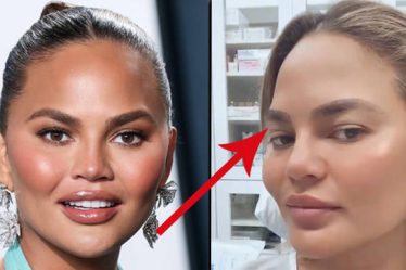 Chrissy Teigen applaudit aux critiques pour avoir subi une greffe de sourcils - 12