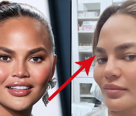 Chrissy Teigen applaudit aux critiques pour avoir subi une greffe de sourcils 87 Chrissy Teigen applaudit aux critiques pour avoir subi une greffe de sourcils - 86