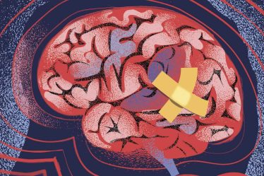 Un neurologue explique comment le cerveau récupère d'une blessure - 6