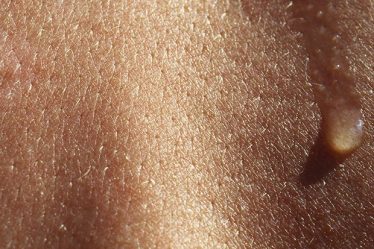 Pourquoi la peau humaine est-elle si fragile ? - 3