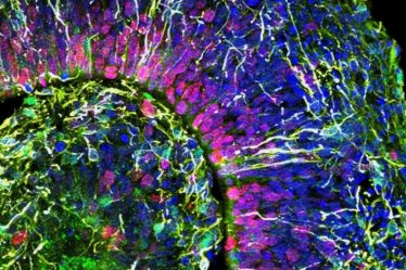 Les organoïdes prennent vie – Sciences et Avenir › Geeky News - 5
