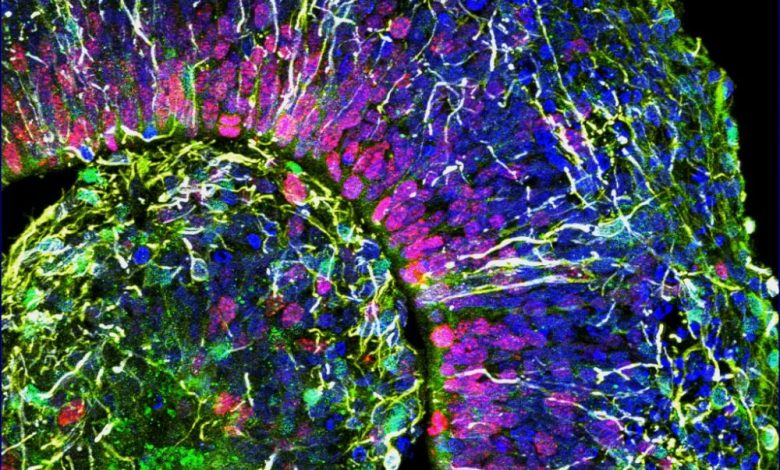 Les organoïdes prennent vie – Sciences et Avenir › Geeky News 2 Les organoïdes prennent vie – Sciences et Avenir › Geeky News - 1