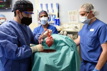 Xénogreffe réussie d'un cœur de porc transgénique – sciences et Avenir › Geeky News - 6