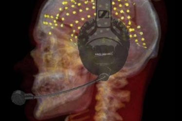 Une nouvelle région du cerveau implied dans la fluidité de la parole – Sciences et Avenir › Geeky News - 3