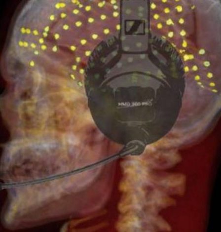 Une nouvelle région du cerveau implied dans la fluidité de la parole – Sciences et Avenir › Geeky News 96 Une nouvelle région du cerveau implied dans la fluidité de la parole – Sciences et Avenir › Geeky News - 95