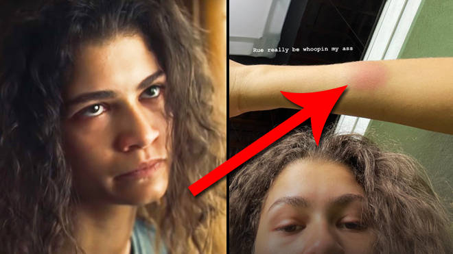 Zendaya a encore "des cicatrices et des bleus" après le tournage d'Euphoria saison 2, épisode 5 3 Zendaya a encore