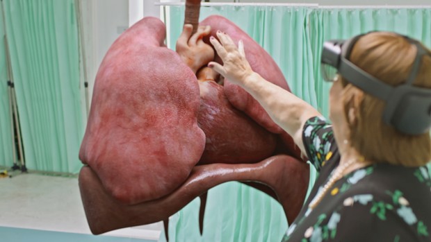 Une patiente, Rozi, a vu une version en réalité augmentée 3D de ses propres poumons © BBC / Remarkable TV Une personne portant un appareil de réalité augmentée tend la main vers une représentation 3D de ses propres poumons.