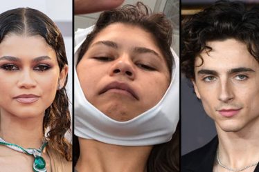 Zendaya avait peur que Timothée Chalamet sente l'haleine de sa "vile" dent de sagesse... - 7