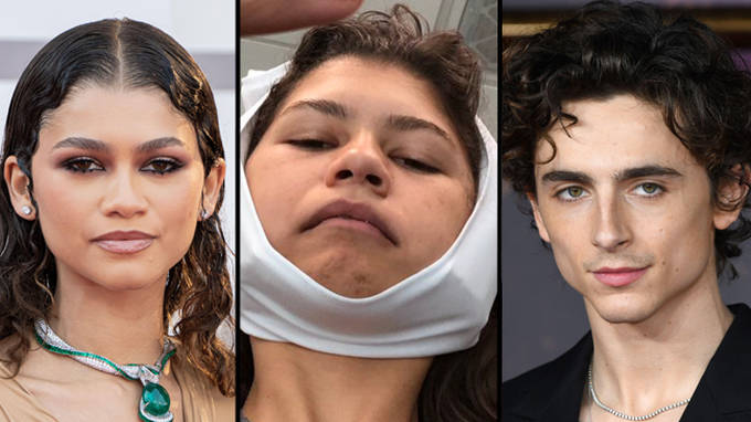 Zendaya avait peur que Timothée Chalamet sente l'haleine de sa "vile" dent de sagesse... 2 Zendaya avait peur que Timothée Chalamet sente l'haleine de sa "vile" dent de sagesse... - 1