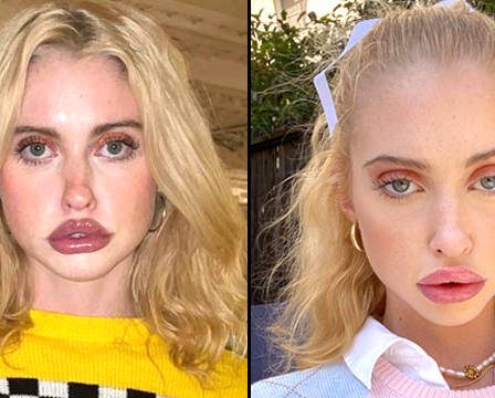 Chloe Cherry d'Euphoria dit que travailler dans le porno l'a amenée à développer un trouble de l'alimentation - 1