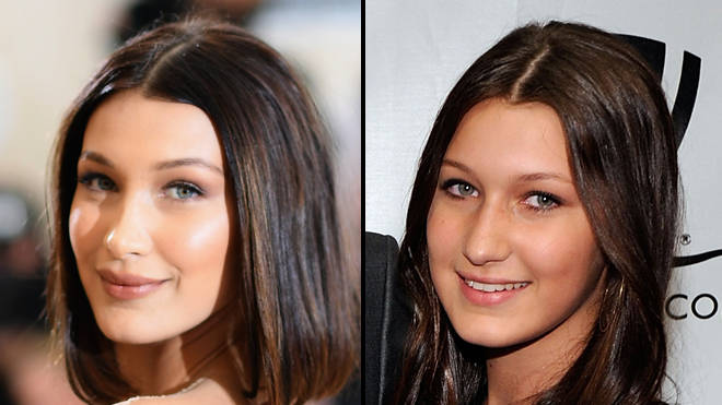 Bella Hadid dit qu'elle regrette de s'être fait refaire le nez à l'âge de 14 ans 3 Bella Hadid dit qu'elle regrette de s'être fait refaire le nez à l'âge de 14 ans
