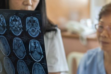 Les zones endommagées du cerveau pourraient expliquer la confusion chez les patients atteints de démence - 3