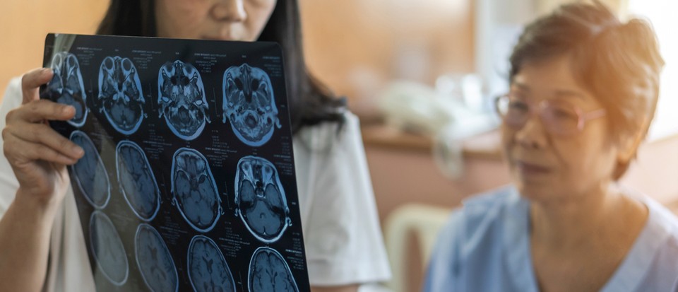 Les zones endommagées du cerveau pourraient expliquer la confusion chez les patients atteints de démence 2 Les zones endommagées du cerveau pourraient expliquer la confusion chez les patients atteints de démence - 1
