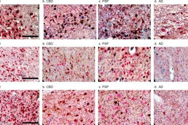 Faire la sieste de façon excessive pourrait être un signe de la maladie d’Alzheimer › Geeky News - 5