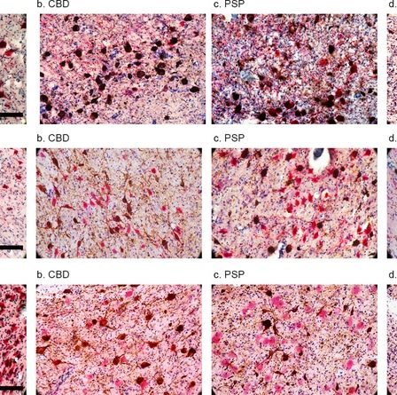 Faire la sieste de façon excessive pourrait être un signe de la maladie d’Alzheimer › Geeky News - 16