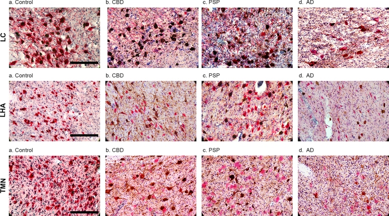 Faire la sieste de façon excessive pourrait être un signe de la maladie d’Alzheimer › Geeky News - 1