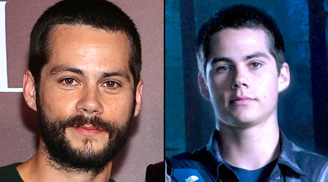 Film Teen Wolf : Dylan O'Brien confirme qu'il ne reviendra pas 3 Dylan O'Brien confirme qu'il ne fera pas partie de Teen Wolf The Movie
