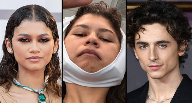 Zendaya avait peur que Timothée Chalamet sente l'haleine de sa "vile" dent de sagesse... 3 Zendaya avait peur que Timothée Chalamet la sente