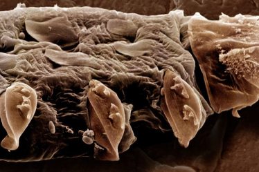 Demodex : Les acariens qui vivent sur votre visage - 5