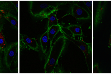 des chercheurs ont réussi à rajeunir de 30 ans des cellules dermiques › Geeky News - 5
