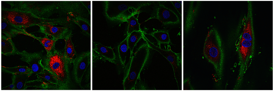 des chercheurs ont réussi à rajeunir de 30 ans des cellules dermiques › Geeky News - 1
