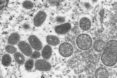 Explication du Monkeypox : pourquoi il se propage, quelles en sont les causes et les symptômes - 6