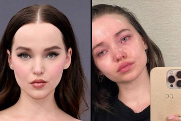 Dove Cameron parle de sa lutte contre la dépression et la dysphorie - 10