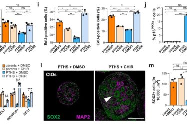 Des chercheurs inversent les effets des mutations liées à l'autisme grâce à la thérapie génique › Geeky News - 7