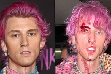 Machine Gun Kelly est parti couvert de sang après avoir brisé une coupe de champagne au visage - 5