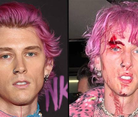 Machine Gun Kelly est parti couvert de sang après avoir brisé une coupe de champagne au visage 83 Machine Gun Kelly est parti couvert de sang après avoir brisé une coupe de champagne au visage - 82