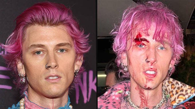 Machine Gun Kelly est parti couvert de sang après avoir brisé une coupe de champagne au visage 2 Machine Gun Kelly est parti couvert de sang après avoir brisé une coupe de champagne au visage - 1