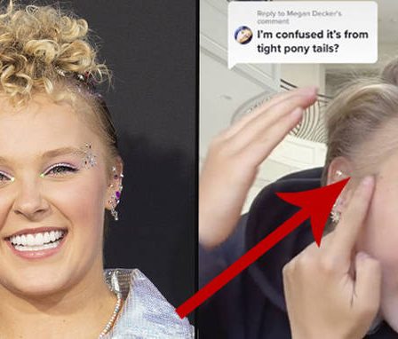 JoJo Siwa dit qu'elle a un "point chauve" causé par le stress des Dance Moms 38 JoJo Siwa dit qu'elle a un "point chauve" causé par le stress des Dance Moms - 37