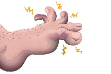 Comment savoir si mon orteil est cassé ou simplement meurtri ? - 6