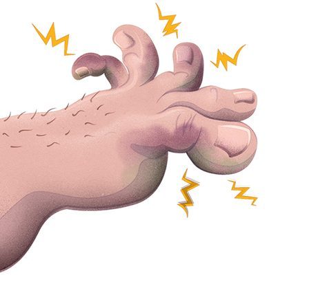 Comment savoir si mon orteil est cassé ou simplement meurtri ? - 52