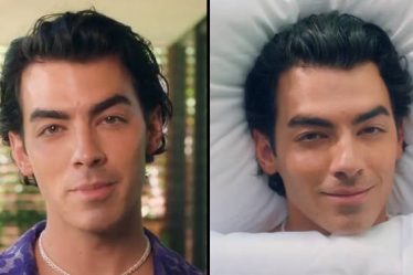 Joe Jonas, 33 ans, est désormais le visage d'une nouvelle alternative au botox nommée Xeomin - 14