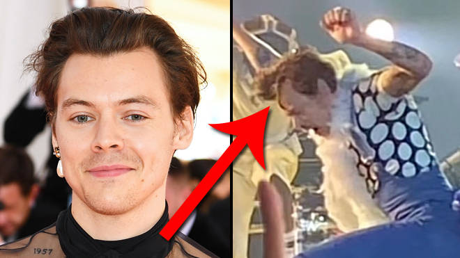 Harry Styles aborde les théories selon lesquelles il est devenu chauve et porte une perruque 3 Harry Styles aborde les théories selon lesquelles il est devenu chauve et porte une perruque