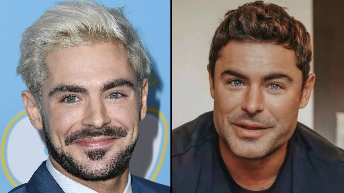 Zac Efron explique ce qui est arrivé à son visage suite aux spéculations sur la chirurgie plastique 2 Zac Efron explique ce qui est arrivé à son visage suite aux spéculations sur la chirurgie plastique - 1