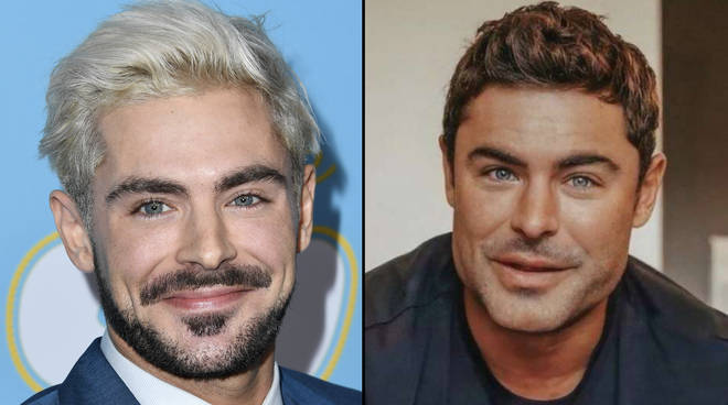 Zac Efron explique ce qui est arrivé à son visage suite aux spéculations sur la chirurgie plastique 3 Zac Efron parle de sa blessure au visage et de ses spéculations sur la chirurgie plastique