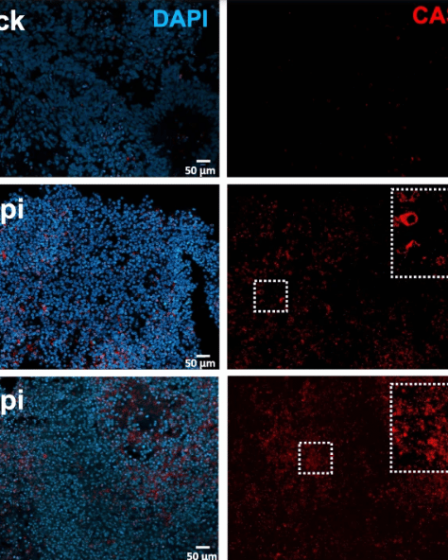 Une perte excessive de connexions neuronales peut expliquer des symptômes cognitifs persistants 30 Une perte excessive de connexions neuronales peut expliquer des symptômes cognitifs persistants - 29