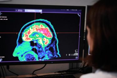 Trois fois plus de victimes d'AVC quittent l'hôpital sans conséquences graves grâce à l'intelligence artificielle - 6