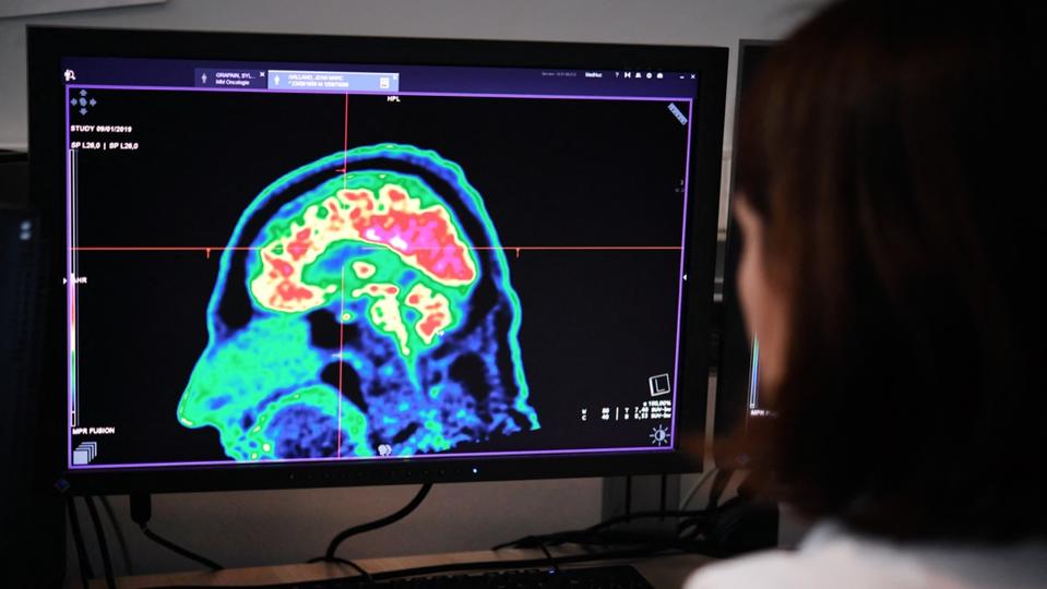 Trois fois plus de victimes d'AVC quittent l'hôpital sans conséquences graves grâce à l'intelligence artificielle - 1